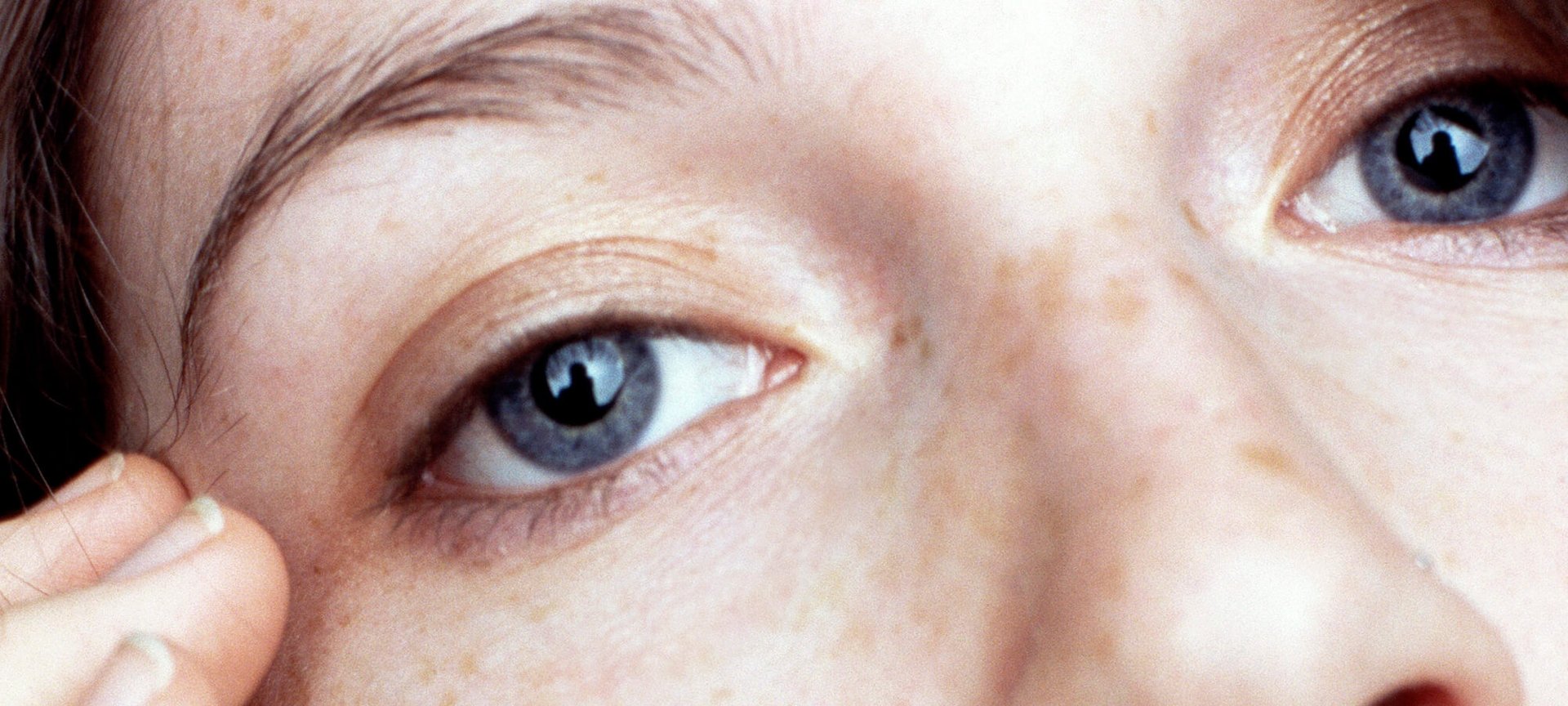 COME AFFRONTARE ED ELIMINARE LE OCCHIAIE