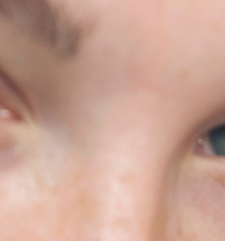 Our Tips To Get Rid Of Eye Bags