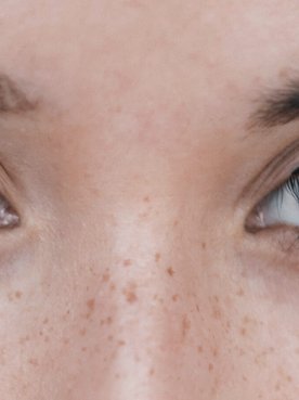 Oxygen A Breath Of Fresh Air For Perfect Skin Article