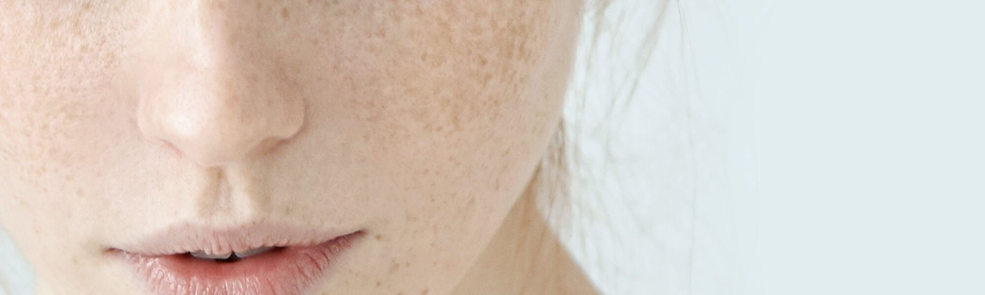 Say No To Skin Imperfections Article