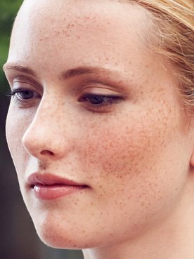 5-domande-risposte-sul-peeling-viso
